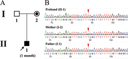 Figure 3 (A) Pedigree information of family 2 with DMD. The proband is marked with a black arrow. (B) Sanger sequencing results of the proband and his parents. The red triangle indicates the mutation site (c.3637A>T).