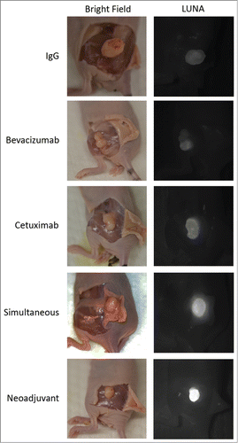 Figure 6. Specificity of Dye Uptake Using FDA-Approved Open-Field Fluorescence Imaging.Representative images demonstrating tumors with skin flaps elevated to simulate a surgical field where the bright field image (left) demonstrates tumor location and the near-infrared fluorescence with the LUNA system(right) illustrates the specificity of cetuximab-IRDye800 to the tumor. Exposure time (1 second) and aperture are equivalent for all images.