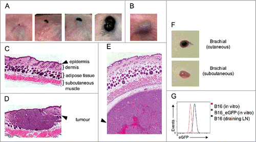 Figure 1. Orthotopic model of cutaneous melanoma. Wild-type B16 melanoma cells were grafted via the (A) cutaneous or the (B) conventional subcutaneous route. Disease progression over time is depicted for cutaneous lesions. (C–E) H & E staining of skin identifying the epidermal, dermal, adipose tissue and subcutaneous muscle layers on (C) uninoculated skin, (D) cutaneous, and (E) subcutaneous tumor grafts. (F) Metastatic disease in the tumor draining brachial lymph node. (G) eGFP expression on cells grown from lymph node explants (green) were compared to B16_eGFP (blue) and parental B16 (red) cells grown in vitro. Data are representative of at least two independent experiments.