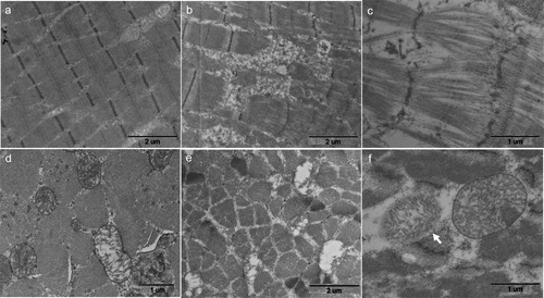 Figure 8. Ultrastructural characterizations of crus haemorrhage in Pekin ducks. (a) Shows normal ultrastructure of Pekin ducks’ skeletal muscles, mitochondria, Z line and M line could be seen in the vertical sections of the skeletal muscles of Pekin ducks. (TEM, ×15,000). (b) shows the rupture of myofibrils; loss of myofibril continuity and rupture of Z line could also be seen (TEM, ×15,000). “Broom”-like myofibers are shown in (c). With increased myofilament spacing and rupture of Z line, myofibrils were just like a “broom” (TEM, ×30,000). (d) Represents the disintegration of mitochondrial cristae (TEM, ×20,000), and (e) shows the vacuolization in mitochondria (TEM, ×15,000). In (f), the mitochondrion in the centre was swollen (arrow), and the other mitochondrion on the left side showed total membranous dissolution (TEM, ×30,000).