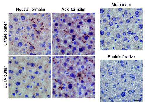 Figure 7. Optimal immunohistochemical detection of LC3B requires processing of tissue samples in a suitable fixative. Liver samples were isolated from Gfp-Lc3tg/tg mice that underwent starvation for 48 h. After fixation in different fixatives for 24 h, tissues were paraffin-embedded and stained for LC3B using biotinylated mouse monoclonal anti-LC3B (clone 5F10, Nanotools, 1:100) and Vectastain ABC. For formalin-fixed samples, heat-mediated antigen retrieval was performed either in citrate buffer (pH 6.0) or in EDTA buffer (pH 8.0). Scale bar, 20 μm.