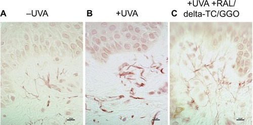 Figure 3 Ex vivo histology using Orcein staining of skin explants (A) before (−UVA), (B) after UVA (+UVA) and (C) after UVA and a preformulation containing a combination of RAL/delta-TC/GGO.