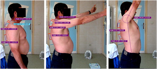 Figure 1. Angular measurements performed with the arms at rest (left), arms parallel to the ground and at full shoulder flexion (right), showing the upper and lower thoracic spine angles (°) and shoulder ROM (°).