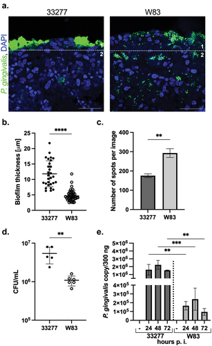 Figure 3.  The OTG model application to differentiate the virulence potential of various P. gingivalis strains. (a) The localization and penetration of ATCC 33277 and W83 strains of P. gingivalis in gingival tissue was visualized using antibodies against bacteria (P. gingivalis, green; nuclei, blue; scale bar, 50 μm). (b) The thickness of biofilm was measured from sector 1; (c) The penetration of bacteria was quantified from sector 2 using ImageJ software and is presented as number of spots ± SD. ****p < 0.0001, **p < 0.01. (d) To detect viable bacteria inside the OTG model, the cultures were lysed at 24 h p.i. And plated for viable counting. The number of viable bacterial cells is expressed as CFU/mL. Each point represents the number of CFU ± SD of at least two replicates. **p < 0.01. (e) Evaluation of bacterial persistence in the infected OTG model by determination of the bacterial DNA number up to 72 h p.i. Bars represent mean ± SD. ***p < 0.001, **p < 0.01. Similar results were obtained in at least two replicates in two independent experiments.