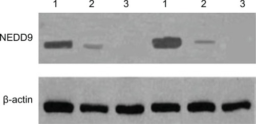 Figure 4 NEDD9 protein expression in each tissue type.