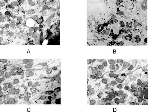 Figure 6 Photographs showing geimsa stained splenic smears of hamster treated with emulsomes and control formulations. A-untreated control group; B-Mycol (AmB for injection) treated group; C-TLEs orTrilaurin based emulsomes treated group; D-TSEs or Tristearin based emulsomes treated group.