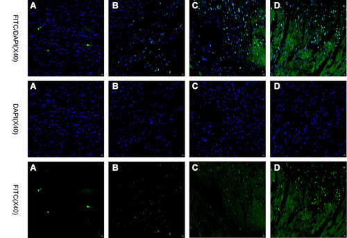 Figure 4 TUNEL staining of heart tissue 1 month after irradiation and/or PD-1 inhibitors treatment in each group. (A) Control; (B) PD-1 inhibitors; (C) Irradiation; (D) PD-1 inhibitors + irradiation.
