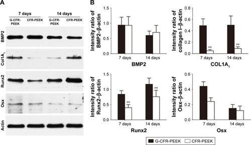 Figure 7 (A) Western blot analysis of osteogenesis-related protein accumulation after culturing with osteoinductive medium on G-CFR-PEEK and CFR-PEEK scaffolds for 7 and 14 days (n=3). (B) Col1A1, Runx2, BMP2, and Osx expression was analyzed using the images shown in A. Results presented as means ± SD. The intensity ratio of Osx-β-actin was significantly different between the G-CFR-PEEK group and the CFR-PEEK group after 7 days’ culture (**P<0.01).Abbreviations: CFR-PEEK, carbon fiber-reinforced polyether ether ketone; G-CFR-PEEK, graphene-modified carbon fiber-reinforced polyether ether ketone.