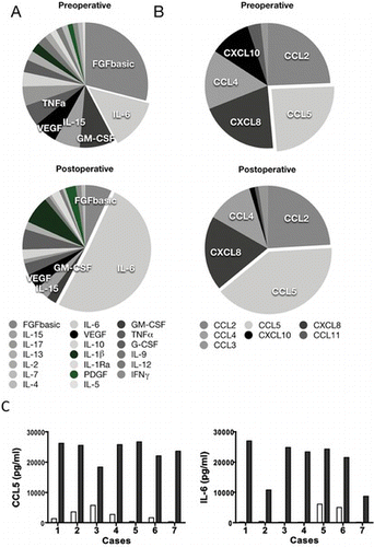 FIGURE 1 Relative amount of measured cytokines (A) and chemokines (B) listed in Table 1. Percentage was calculated by dividing the concentration of cytokines or chemokines (pg/mL) with sum of the concentrations (total concentration) of measured cytokines or chemokines (pg/mL). (C) Data from an individual case for CCL5 and IL-6 are shown. Blank bars, preoperative concentration; solid bars, postoperative concentration. The case number indicates the patient ID in Table 1 (color figure available online).