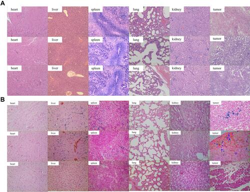 Figure 7 (A) The H&E staining of different organs including hearts, livers, spleens, lungs, and kidneys. No obvious pathological changes were observed. (B) Prussian Blue staining analyses of ex vivo.