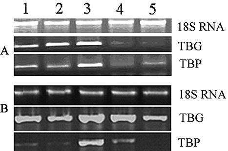 Figure 1 Effect of UV-B on expression of TBG and TBP genes in tea shoots. A: Cultivar Maoxie; B: cultivar Anhui-9; TBG: β-glucosidase gene; and TBP: β-primeverosidase gene. 1: Freshly picked tea shoot (0 h); 2: Under dark condition for 2 h; 3: UV-B irradiation for 2 h; 4: Under dark condition for 6 h; 5: UV-B irradiation for 6 h.