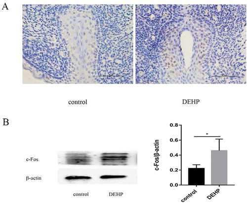 Figure 3. Immunoreactivity (x400) and western blotting analysis of male GTs in the control and DEHP groups. Image of anti-c-Fos antibody staining (brown) indicating c-Fos expression in the urethral epithelium of the male GT, especially in the urethra plate region at ED19 (A). c-Fos staining was stronger in the DEHP group than in the control group. Western blot analysis showed a significant difference in c-fos expression in the GT between the control and DEHP groups (p < 0.05)