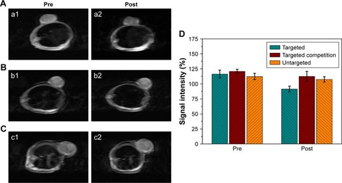 Figure 8 In vivo MR imaging.Notes: (A) Targeted group; (B) targeted competition group; (C) untargeted group. MR images of tumor area pre- and postinjection (a1, b1, c1 and a2, b2, c2, respectively) with corresponding contrast agent. (D) Corresponding MR signal-intensity percentages in tumor regions of interest.Abbreviation: MR, magnetic resonance.