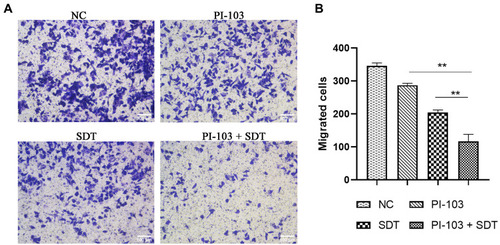 Figure 7 Combination treatment suppressed migration viability of HepG2 cells. (A) Transwell assay was performed in HepG2 cells to investigate the inhibitory effect of combination treatment on HCC metastatic processes. (B) Quantitation of migrated cell number of HepG2 cells. **p<0.01.