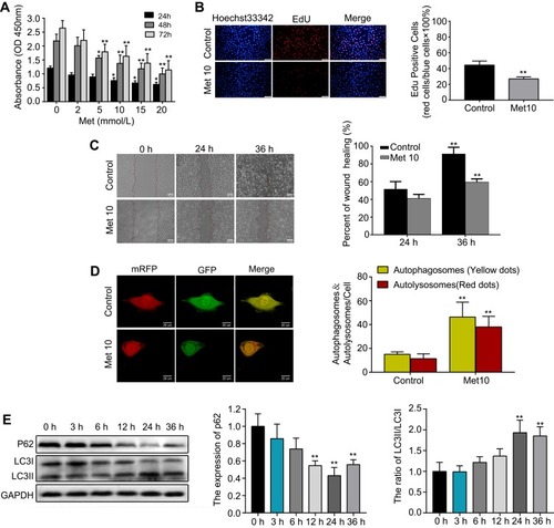 Figure 2 Metformin (Met) suppresses proliferation and migration while induces autophagy in HUVECs.