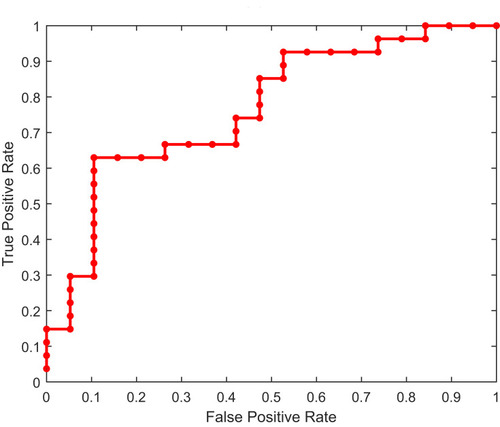 Figure 5 ROC curve of DR predicted by BP-ANN model (data of our hospital).