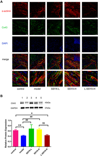 Figure 7 Effects of SSYX on the gap junction of myocardial cells and the protein expression of Cx43. (A) Representative images of immunofluorescence double staining for each group, α-actinin, Cx43, and DAPI were marked in red, green, and blue respectively (200 ×). (B) The protein expression of Cx43. Values measured are presented as the mean ± SD (n = 3). **P < 0.01 vs control group. *P < 0.05 vs control group. ##P < 0.01 vs model group. $$P < 0.01 vs SSYX-H group.