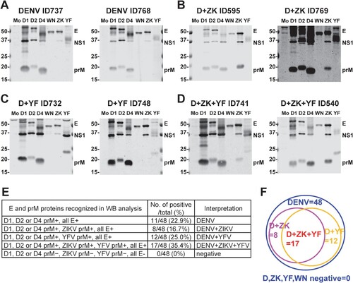 Figure 3. Antibody response to six flavivirus antigens in samples from suspected ZIKV cased during the ZIKV outbreak in Brazil. (A-D) Results of participants with previous DENV infection (A), previous DENV and ZIKV infections (D + ZK) (B) previous DENV and YFV infections/vaccination (D + YF) (C), and previous DENV, ZIKV and YFV infections/vaccination (D + ZK + YF) (D). The positions of E, NS1 and prM protein bands are indicated. The size of molecular weight markers is shown in kDa. Mo: mock, D1: DENV1, D2: DENV2, D4: DENV4, WN: WNV, ZK: ZIKV, and YF: YF-17D. (E,F) The pattern of E and prM proteins recognized and the number/percentage of positive and total samples based on Western blot analysis (E) and a graphic summary (F).