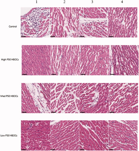 Figure 5. Representative photomicrographs of HE-stained of myocardium in each group. Magnification *400, scale bar: 50 μm. 4 photomicrographs per group. The inflammation of photomicrographs of HE-stained of cardiac tissue in the low P50 HBOCs was significantly lower than the control group and Medium P50 HBOCs. The first group serves as a control group to study the protection of the myocardium in the other three groups.