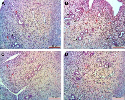 Figure 3 MDA immunoreactivity is shown in endometrial glands in uterus (black arrows) and in stromal cells (red arrows).