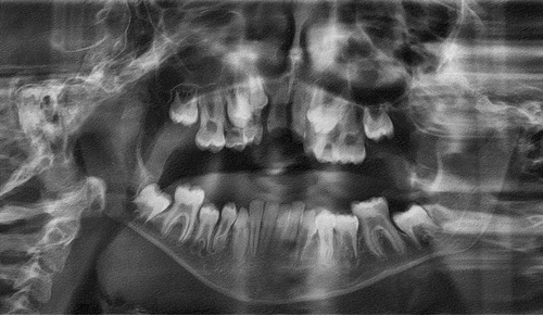 Figure 3. Panoramic radiography.