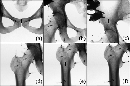 Figure 4. Upper row: Two-dimensional fluoroscopic images of the pelvis with the imaging center on the pubic symphysis (a), the acetabular fossa (b), and a site on the ilium 3 cm above the acetabular roof (c). Lower row: Two-dimensional fluoroscopic images of the proximal femur with the imaging center on the base of the femoral neck (d), the femoral shaft at the level of the lesser trochanter (e), and the inferior border of the great trochanter (f). The fluoroscopic imaging centers are indicated with crosshairs.