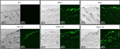 Figure 5 CLSM images of the rat skin penetration of curcumin-loaded micelle formulations with different particle sizes without or with of microcurrent cloth. Right side of each picture indicates the fluorescence image of curcumin, and left side pictures are bright view images. Scale bar: 200 μm.