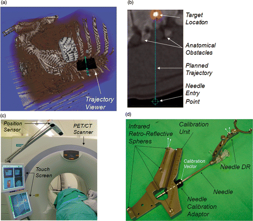 Figure 2. (a) 3D viewer showing an overview of the planned situation and the orientation of the trajectory viewer. (b) Trajectory viewer showing the planned trajectory and possible obstacles. (c) Navigation platform beside the PET/CT scanner table. (d) Needle and calibration unit in calibration position.