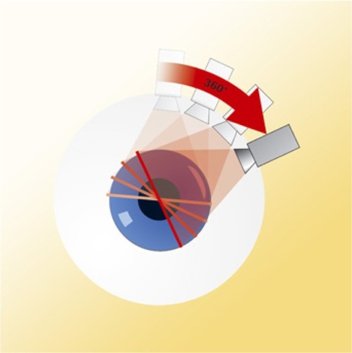 Figure 2 Scheimpflug technique performed by Pentacam.