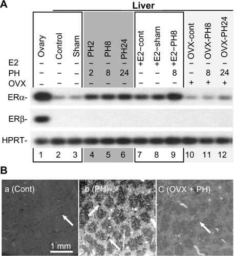 Figure 4 PH induced ERα expression in the hepatocyte of periportal area.