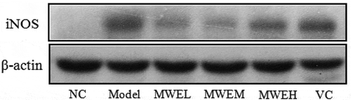 Figure 3. Effect of Momordica charantia water extract on iNOS expression in the livers of restraint-stressed mice. NC, normal control; Model, restraint stress model; VC, restraint-stressed mice treated with vitamin C 250 mg/kg bw; MWEL, restraint-stressed mice treated with M. charantia water extract 250 mg/kg bw; MWEM, restraint-stressed mice treated with M. charantia water extract 500 mg/kg bw; MWEH, restraint-stressed mice treated with M. charantia water extract 750 mg/kg bw.