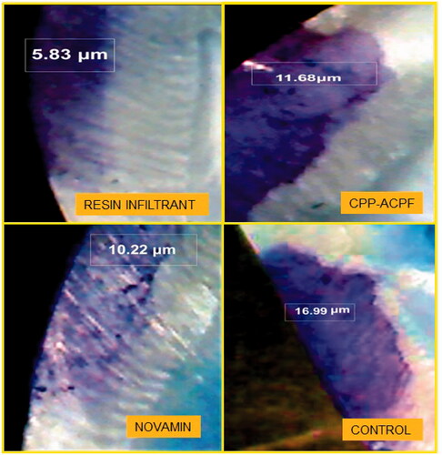 Figure 1. Dye penetration depth of different materials under study.