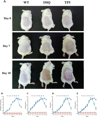 Figure 1 TP5 ameliorates the psoriasis-like skin inflammation phenotype in IMQ-induced mice. (A) Phenotypic expression of genes in the dorsal skin of mice. Mice were divided into three groups, and each mouse was photographed before IMQ treatment and after TP5 treatment. (B–E) Line graphs showing cumulative PASI scores, skin erythema, desquamation and changes in skin thickness in mice. Each parameter was scored daily. The scores are expressed as the mean ± standard deviation. nsP ≥ 0.05, ***P < 0.001, TP5 group vs IMQ group.