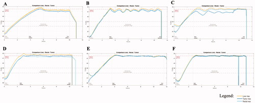 Figure 2. Comparison of the maximal liver, rectal and tumor temperatures monitored during whole-body thermal treatment. (A) dog n°1, WBTT1 (there was no monitoring of the rectal temperature with ElmediX sensors during this case, only with a standard hospital probe); (B) dog n°2, WBTT2; (C) dog n°3, WBTT1; (D) dog n°4, WBTT1; (E) dog n°5, WBTT1; (F) dog n°6, WBTT3. During plateau-phase, there is a fluctuation of temperature around the set-point (41.5 °C). Over time, the temperature accuracy improved (A and B as compared to F). By adding extra heating patches on superficial tumors located far from the core, treatment temperature at 41.5 °C was reached (F).