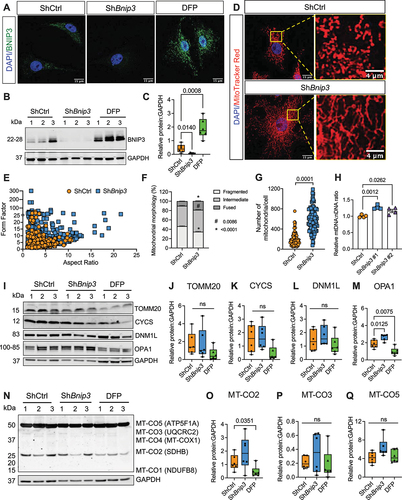 Figure 1. BNIP3 loss in NP cells affects mitochondria number and morphology. (A) Immunofluorescence staining for BNIP3 in ShCtrl- and ShBnip3 #1-transduced cells and 24-h DFP-treated cells. (B, C) Western blot of BNIP3 and corresponding densitometric analysis of multiple blots shown in NP cells after transduction with Bnip3 shRNA #1. (D) NP cells transduced with ShBnip3 showed tubular and well-networked mitochondria compared to ShCtrl. Scale bar: 15 and 4 μm. (E, F) Mitochondrial morphology and network analysis showed increased length and branching complexity of mitochondria in BNIP3-deficient NP cells. (G, H) Increase in mitochondrial number and mitoDNA content in BNIP3-deficient cells; 50 cells quantified from two independent experiments for data shown in G. (I-M) Immunoblot and quantification of mitochondrial outer membrane translocase TOMM20, inner membrane protein CYCS, fission protein DNM1L and fusion protein OPA1. (N-Q) Western blot and corresponding densitometry analysis of ETC proteins. Data represent six independent experiments. Statistical significance was determined using t-test (F, G) or One-way ANOVA (I-L, N-P) with Sidaks’s post hoc test as appropriate.