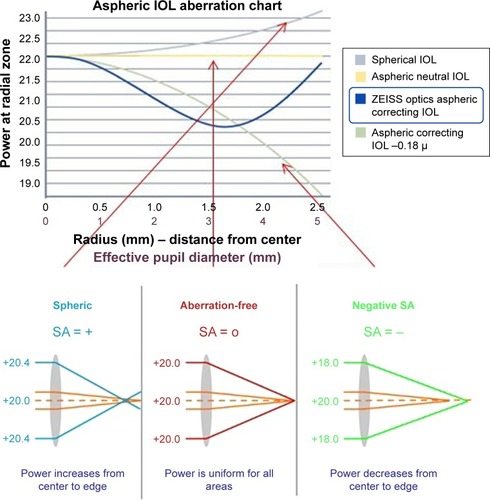 Figure 6 Zeiss asphericity concept ZO: combining the advantages from negative spherical aberration and aberration-neutral lenses. Courtesy of Zeiss Meditec (Jena, Germany).