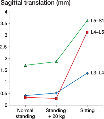 Figure 1:5A Mean mobility along the sagittal axis over the lower 3 lumbar segments in 12 patients, investigated in 3 standardized positions of provocation.
