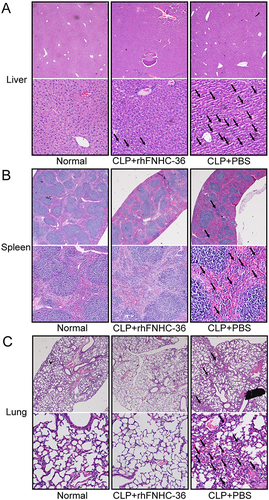 Figure 2 rhFNHC-36 improved histological pathology in the liver, spleen, and lung tissues from mice with CLP-induced sepsis. (A-C) Representative images of H and E staining for liver (A), spleen (B), and lung (C) tissues of mice in the indicated groups. Each panel shows one tissue type sampled from the normal, CLP+rhFNHC-36 and CLP+ PBS groups, as indicated, at 24 h after CLP. Magnification: 100×, upper panel; 400×, lower panel. Arrows indicate the histopathologic changes in liver (compromised liver architecture and cellular integrity), spleen (disrupted structure of white pulp and red pulp, less apparent marginal zones), and lung (disrupted histological architecture, diffuse thickening in interstitial tissue with eosinophilic and histiocytic infiltration) tissues.