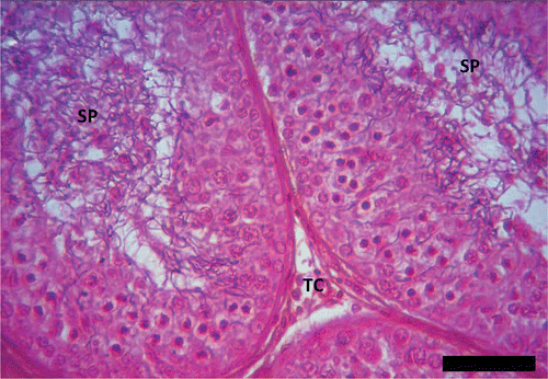 Figure 4. Peak of spermatogenesis in Pelusios castaneus. SP: spermatozoa; TC: interstitial cell (September). H&E: haematoxylin & eosin. Scale bar: 100 µm.