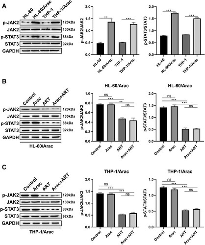 Figure 3. ART suppresses JAK/STAT3 signaling in AraC-resistant AML cells. A: Western blotting measurement of p-JAK2, p-STAT3, JAK2, and STAT3 protein levels in AraC-sensitive and AraC-resistant AML cells. B: Western blotting measurement of p-JAK, p-STAT3, JAK, and STAT3 protein levels in the HL-60/AraC cells treated with AraC (IC50) and ART (0.05 μM) alone or together. C: Western blotting measurement of p-JAK2, p-STAT3, JAK2, and STAT3 protein levels in the THP-1/AraC cells treated with AraC (IC50) and ART (0.05 μM) alone or together. Data: mean ± SEM. **P < 0.01, ***P < 0.001. n = 3.