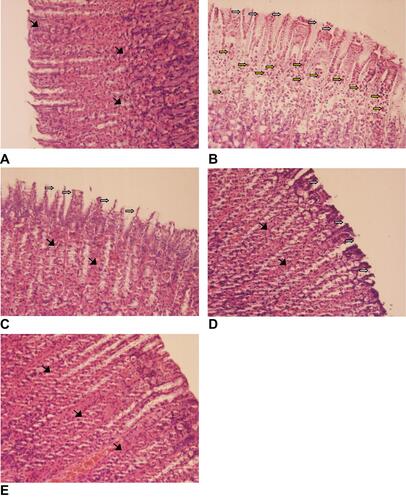 Figure 3 Histopathological examination of rats’ stomachs. Samples were from the stomach of a normal rat (A), a rat with the gastric ulcer treated with saline (B), a rat with the gastric ulcer treated with 100 mg/kg BW sucralfate (C), and rats with the gastric ulcer treated with 25 mg/kg BW DLBS2411 (D) and 50 mg/kg BW DLBS2411 (E). The slices were stained with hematoxylin and eosin and then examined under an optical microscope (20×). Mucosal desquamation (white arrows); necrosis of gastric mucosa (yellow arrows); undamaged gastric mucosal architecture (arrowheads).
