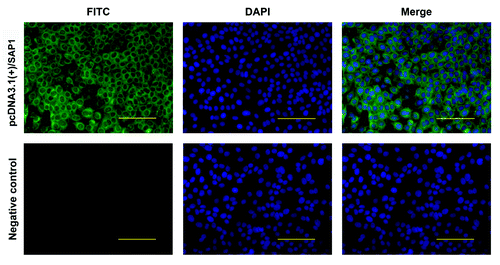 Figure 2. Detection of the PySAP1 recombinant protein expression in COS-7 cells by IFA. The PySAP1 protein was detected using a polyclonal mouse antiserum and FITC-conjugated goat anti-mouse IgG antibodies. Immunofluorescence of cells transfected with pcDNA3.1(+)/SAP1 or negative control pcDNA3.1(+)/CpG was compared. Green fluorescence from FITC indicates PySAP1 expression. Nuclei were counterstained with DAPI (blue). Scale bar = 50.0 μm.