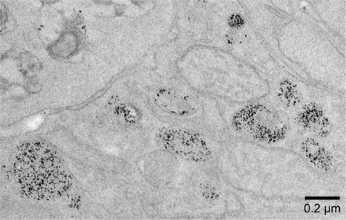 Figure 1 TEM of VSOP in atherosclerotic plaques.Notes: After intravenous injection, VSOP accumulate in atherosclerotic plaques of ApoE−/− mice as aggregates in phagolysosomal structures of macrophages as shown here, as well as in endothelial cells (not shown).Citation7 The small iron oxide cores themselves provide the native contrast for TEM of unstained tissue sections and are separately distinguishable.Abbreviations: TEM, transmission electron microscopy; VSOP, very small iron oxide particles.