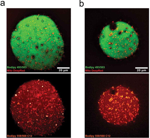 Figure 6. (ab) Confocal images of isolated adipocytes incubated with bodipy 558/568 C12, followed by staining with bodipy 493/503 and MitoTracker deep red. Upper panel is bodipy (green, neutral lipids) and MitoTracker (mitochondria, red), lower panel shows bodipy 558/568 C12 (red-white). Images illustrates the presence of the lipid analogue bodipy 558/568 C12 in small droplet clusters, the central lipid droplet and in mitochondria. Scale bar = 20 µm