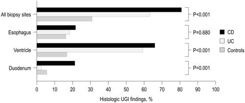 Figure 1. Histological UGI findings in 47 children with CD, 76 children with UC and 162 control children who underwent upper and lower gastrointestinal endoscopies but were not diagnosed with any organic condition.