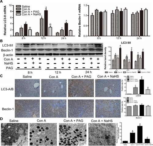 Figure 4 H2S attenuates autophagy in Con A-induced hepatitis in mice.