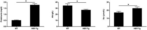 Figure 1. Renal impairment in HBV-Tg mice. Proteinuria, serum albumin and creatinine levels in WT and HBV-Tg mice at 24 weeks were measured. Data are presented as the mean ± SD. *p < 0.05.