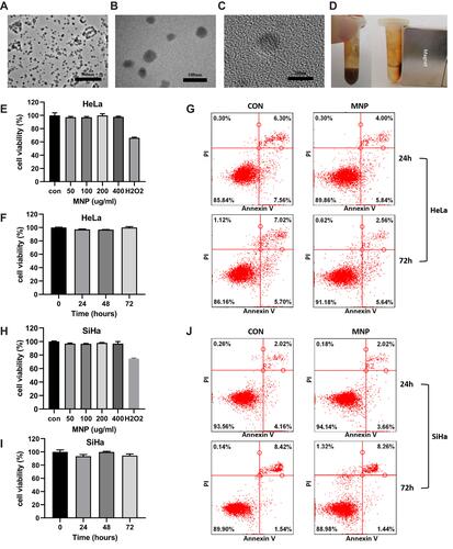 Figure 1 Properties of MNP in cervical cancer cells. (A and B) TEM images of MNPs in 25,000× (A), 80,000× (B), 600,000× (C). (D) MNP exhibited room temperature superparamagnetism with good magnetic field responsivity towards the external magnet. Effect of the MNP on the viability of the HeLa (E and F) and SiHa (H and I) cells via the MTT assay. Cells were treated with MNP for 0–72h at a concentration range 0–400μg/mL, H2O2 (0.5mM) were employed as positive control. HeLa (G) and SiHa (J) cells treated with MNP (100μg/mL) for 24 and 72 h were stained with FITC-labeled annexinV/PI and subsequently subjected to flow cytometry analysis.