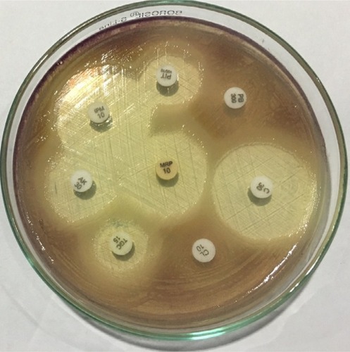 Figure 5 Antimicrobial susceptibility test of Chromobacterium violaceum.