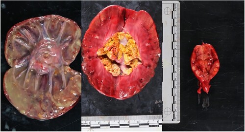 Figure 3. Photographs of organs of a dog with disseminated fungal infection with Rasamsonia argillacea species complex, showing (left) copious purulent material occupying the entire right kidney, (middle) the left kidney with dry, caseous material within the renal pelvis, and (right) a mesenteric lymph node with multiple white nodules on the cut surface.